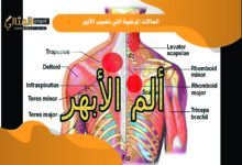 ما الحالات المرضية التي تصيب الأبهر