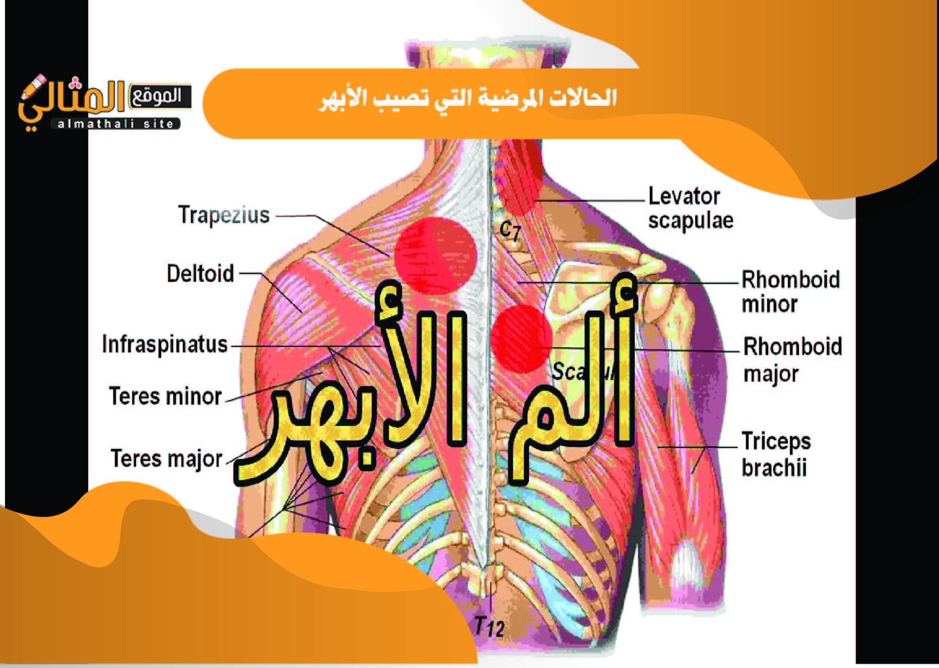 ما الحالات المرضية التي تصيب الأبهر